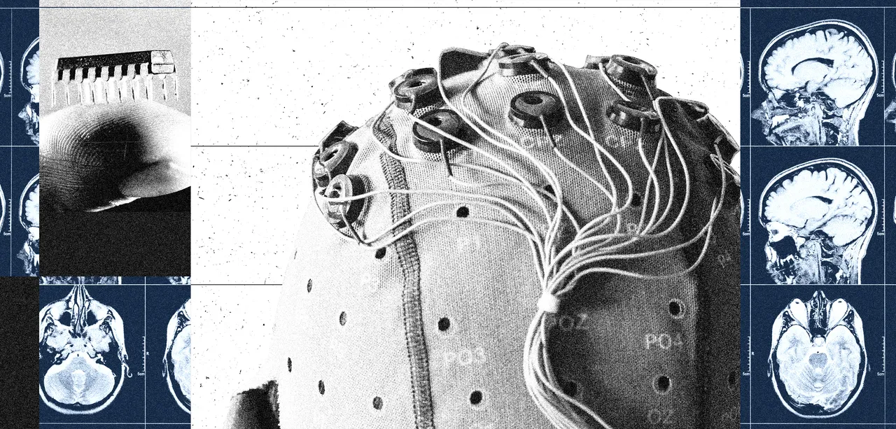 China Is Building a Brain-Computer Interface Industry