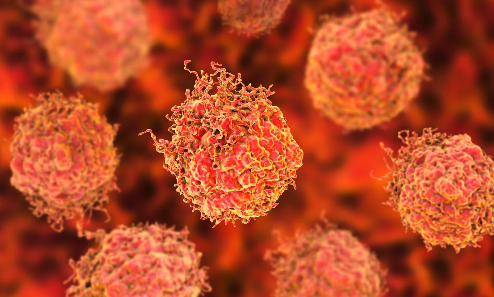 Prostate cancer surgery breakthrough offers hope for erectile function